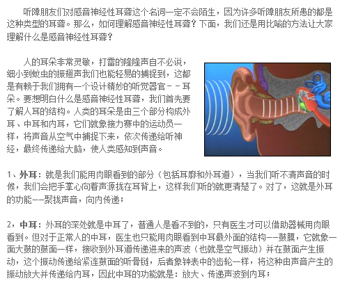 白话遗传学术语 之二何谓感音神经性耳聋